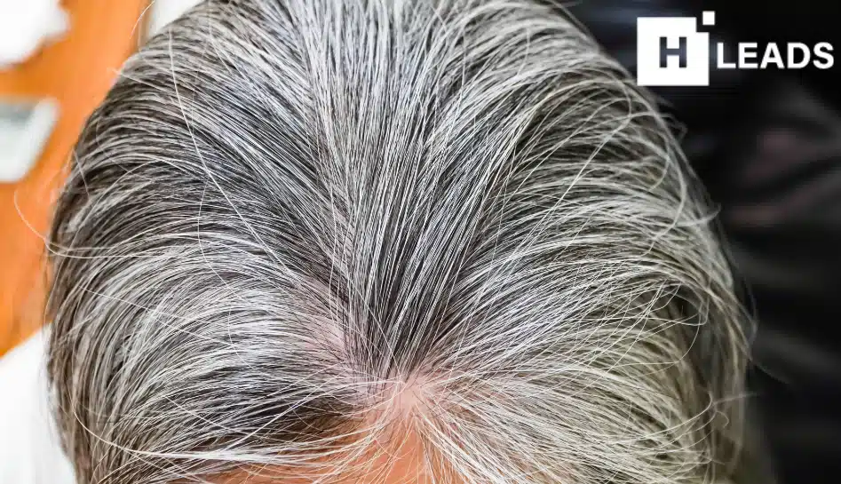 Slim and Shine  3 easy tips for Mens on stopping greying of hair in young  age Do use them and comment  greyhair men stopgreyhair slimandshine   Facebook