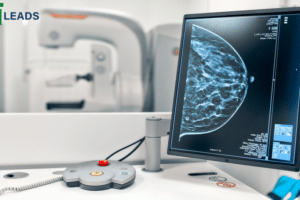 AI mammography