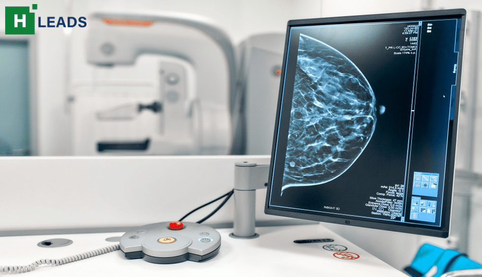 AI mammography